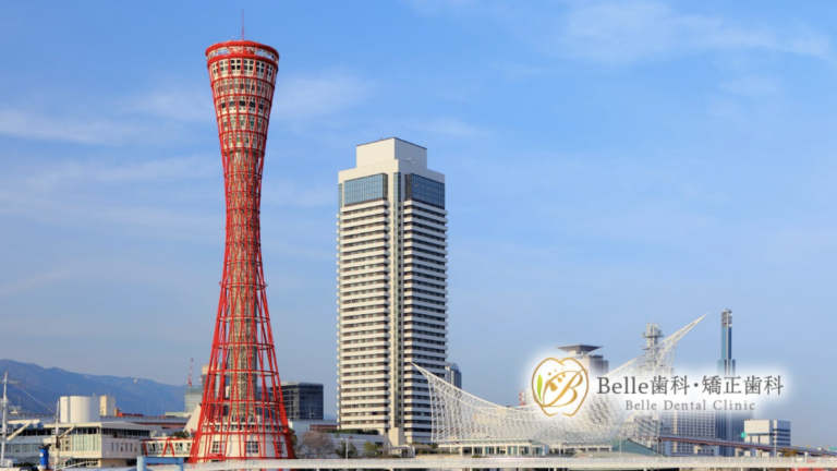 【神戸市】マウスピース矯正の選び方完全ガイド