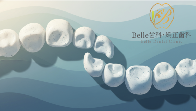 矯正治療後の後戻りはなぜ起こる？生活習慣・癖から見直す5つのポイント