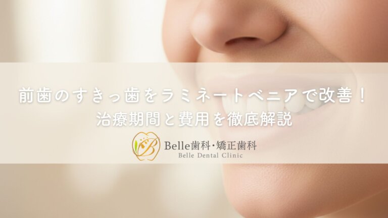 前歯のすきっ歯をラミネートベニアで改善！治療期間と費用を徹底解説