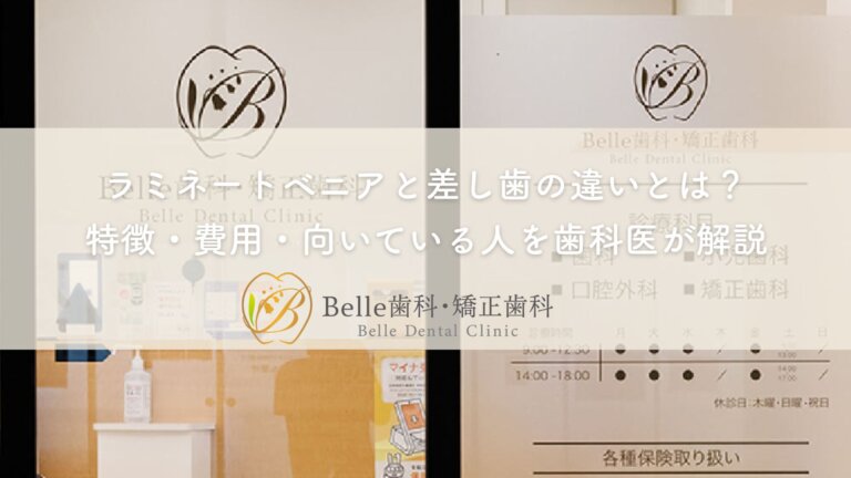 ラミネートベニアと差し歯の違いとは?特徴・費用・向いている人を歯科医が解説